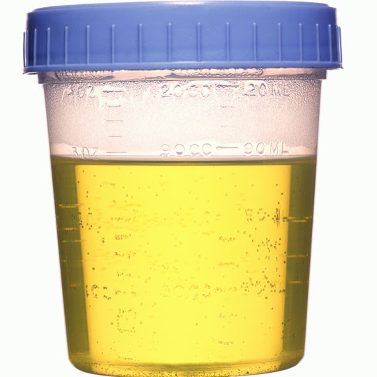 urine-specimen-cup__44522_0924aa8b-864a-47df-936f-58d9cebdbf21